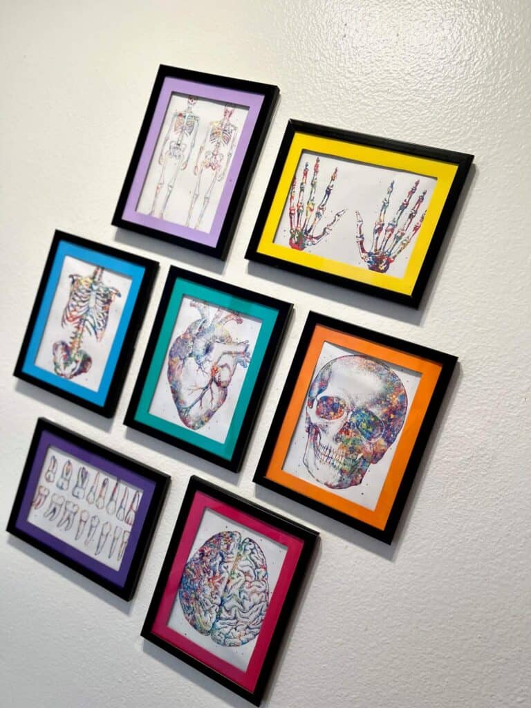 Human anatomy pics that are rainbow color on black frames with rainbow colored mats.